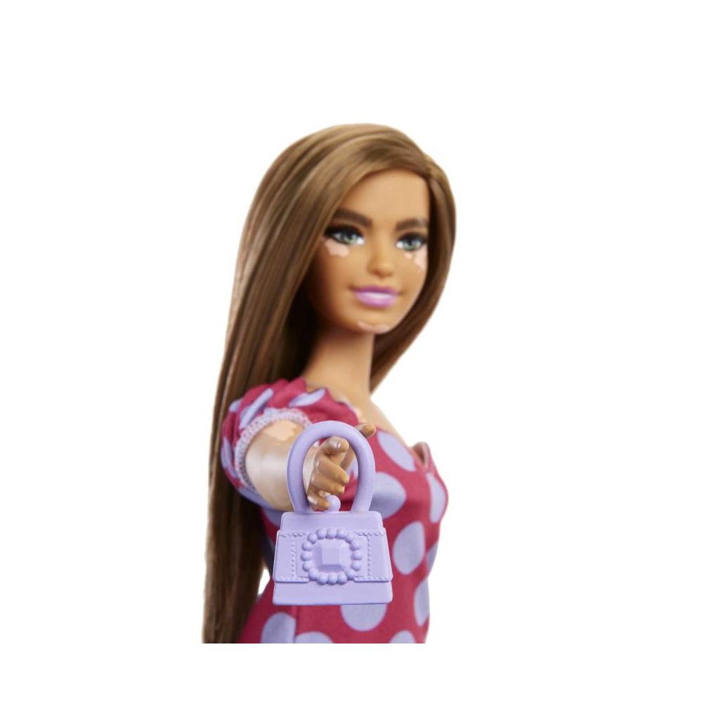Barbie Fashionista Curvy Vitiligo Vestido Com Bolas